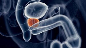 Prostata: 5 Symptome für eine kranke Prostata