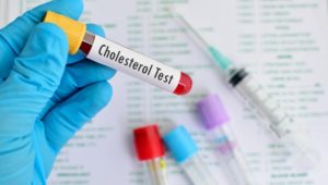 Cholesterinspiegel messen: Darum sollten Sie Ihre Blutfettwerte regelmäßig checken