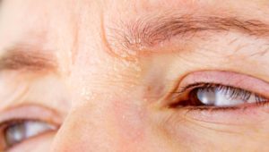 Ekzem am Auge: Was die juckende Entzündung auslöst