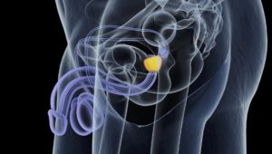 Symptome für eine vergrößerte Prostata