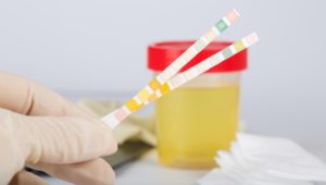 Der Pipi-Check: Was der Urin über die Gesundheit verrät