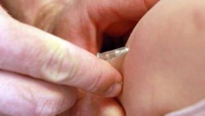 Laut Gesundheitsministerium: Masern-Nachimpfung betrifft wohl 600.000 Menschen